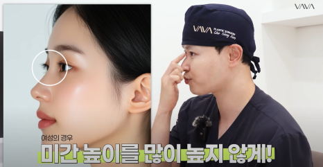 화려한 코성형, 높이만이 답일까?｜압구정 바바성형외과 코성형 꿀팁 관련 이미지 7