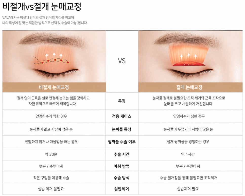 졸려 보인다는 말 자주 듣는다면? | 바바성형외과 눈매교정이 필요한 경우 관련 이미지 6