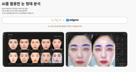 여름 쌍꺼풀 수술, 왜 오히려 더 추천할 수도 있을까? 바바성형외과에서 알려드립니다. 관련 이미지 8