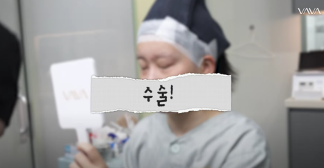 바바성형외과 눈&middot;코 성형 한 달 차 리얼 케이스 (윈터, 카리나 코) 관련 이미지 10