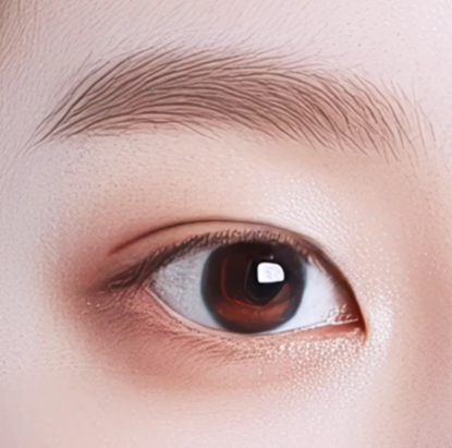 쌍수만으로 충분할까? 윗트임 병행이 필요한 경우 관련 이미지 13