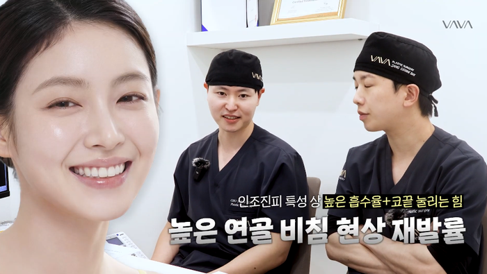 코성형 재료 어떤게 좋을까? ㅣ 코성형 재료의 모든 것, 코 재료 총정리 관련 이미지 10