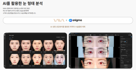 졸려보이는 눈 자연유착 밑트임 위트임으로 또렷하게 (리얼 후기) 관련 이미지 15