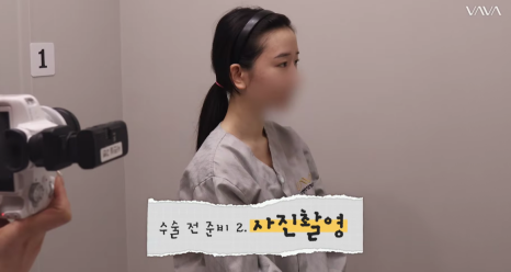 졸려보이는 눈 자연유착 밑트임 위트임으로 또렷하게 (리얼 후기) 관련 이미지 7