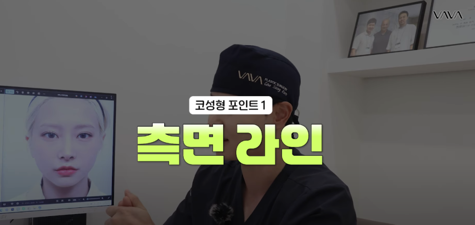 코재수술 원인, 과연 코끝처짐만이 문제일까? 가장 이상적인 라인 알려드립니다 관련 이미지 2