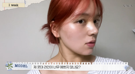 보형물 없이 선명하게｜바바성형외과 무보형물 매부리코 교정 리얼 후기 관련 이미지 13