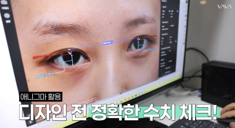 과하지 않게 또렷한 눈매, 세미아웃라인&middot;인아웃라인 쌍꺼풀 인기 이유 관련 이미지 11