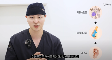 압구정 바바성형외과 | 코성형의 핵심, 비주의 중요성과 교정 방법 관련 이미지 15