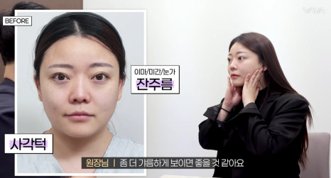 결혼식 전, 더 예쁜 나를 위한 작은 준비 (웨딩 시술 리얼 후기) 관련 이미지 12