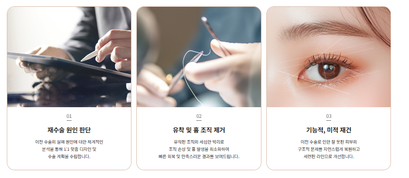 쌍수 재수술 성공기 ｜ 졸려보이는 눈 세미아웃으로 예뻐진 리얼 Before & After 관련 이미지 18