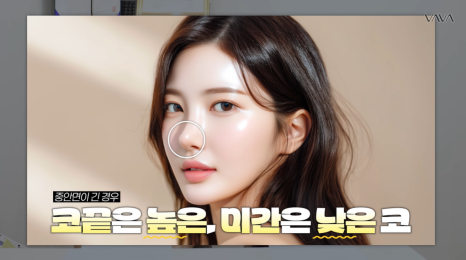 첫 코 성형, 언제&middot;어떻게 해야 할지 기준 정리해드립니다 관련 이미지 30