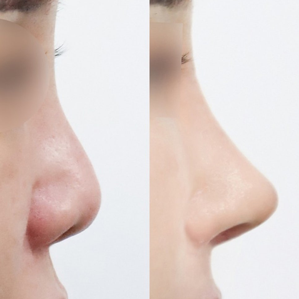 코유형에 따른 인상 관련 이미지 2