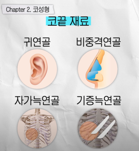 요즘 코성형 트렌드 & 코끝 재수술 알아보기 관련 이미지 5