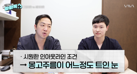 세미아웃라인 인아웃라인 쌍꺼풀 잘 받는 타입 (몽고주름) 관련 이미지 7