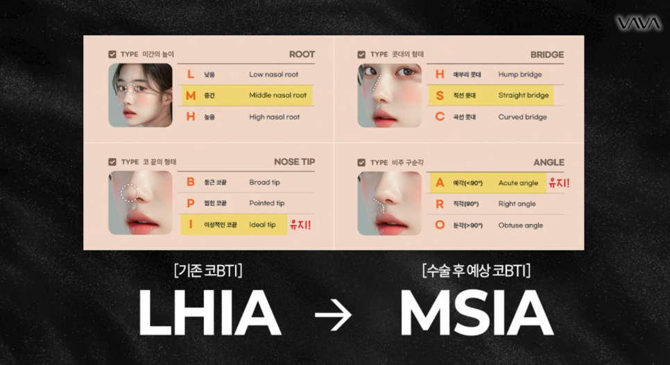 Analysis Based on Actual Rhinoplasty Cases | Baba Plastic Surgery image 6