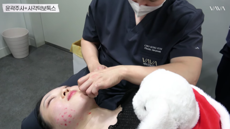 울쎄라 효과 언제부터? 윤곽까지 바뀌는 리프팅, 압구정 바바성형외과(리얼후기) 관련 이미지 21