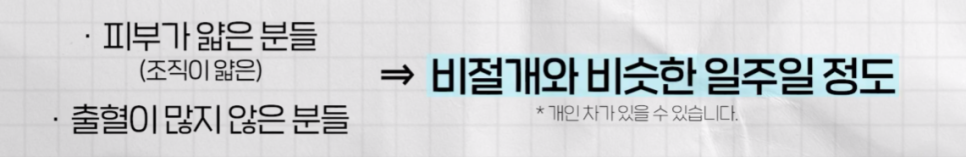 나에게 맞는 쌍꺼풀 수술법 총정리 : 절개, 부분절개, 매몰법까지 관련 이미지 11