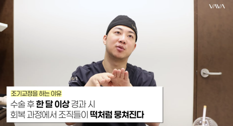 쌍수 후 생겨버린 짝눈 교정 눈의 균형을 맞추는 섬세한 방식 관련 이미지 29