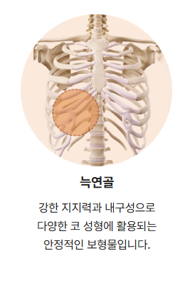 코성형 재료 어떤게 좋을까? ㅣ 코성형 재료의 모든 것, 코 재료 총정리 관련 이미지 3