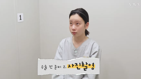 바바성형외과 눈&middot;코 성형 한 달 차 리얼 케이스 (윈터, 카리나 코) 관련 이미지 8