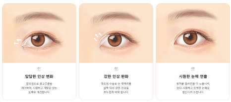 최준희 코 재수술 눈 재수술 성형 분석 관련 이미지 8