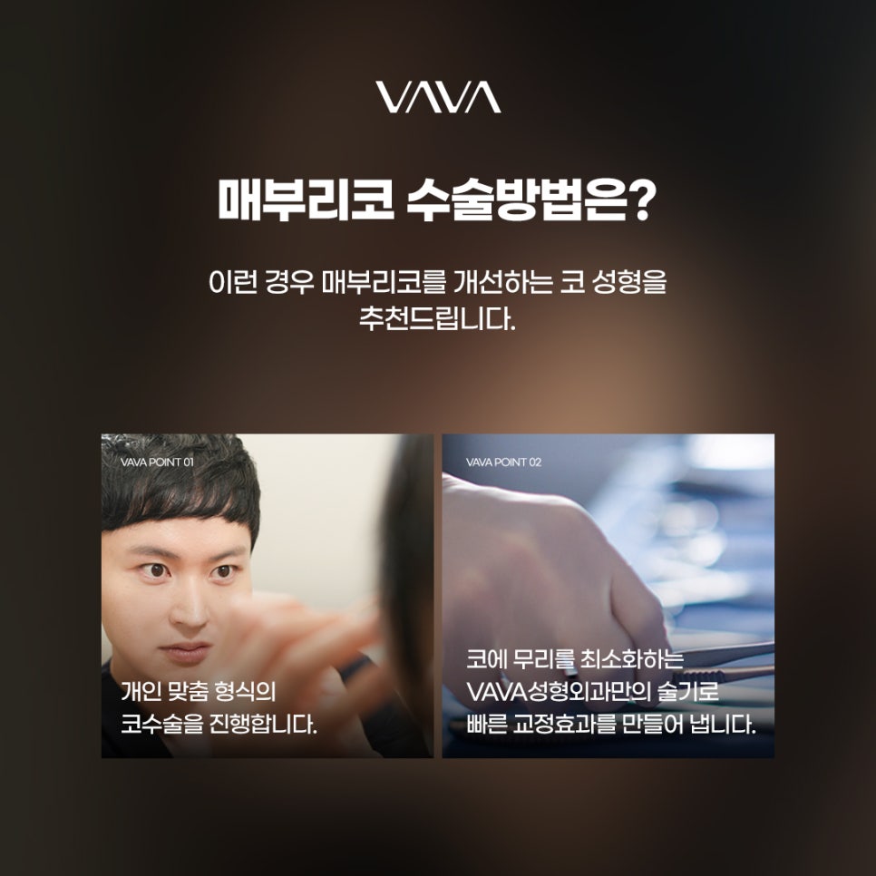 매부리코수술 교정법부터 체크할 사항 관련 이미지 6