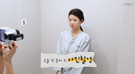 압구정 바바성형외과 자가늑 코성형 후기｜복코&middot;매부리코 교정 한달차 변화 관련 이미지 6