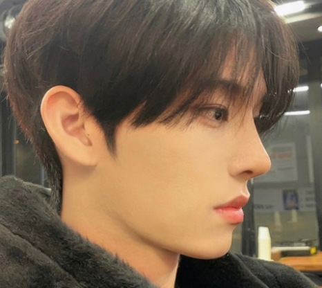 코 재수술, 첫 수술보다 더 신중해야 하는 이유 관련 이미지 20