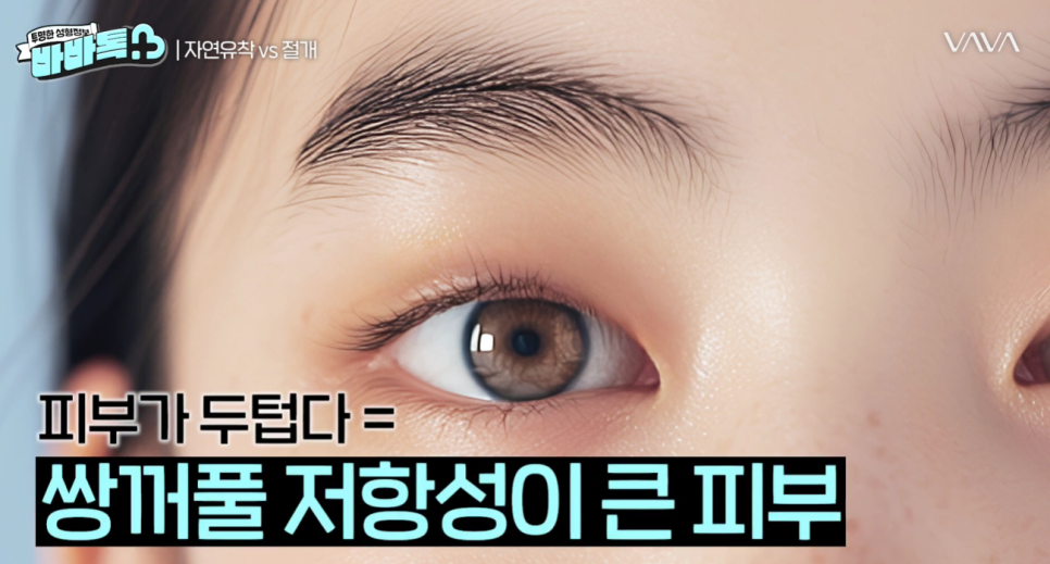 나에게 맞는 쌍꺼풀 수술법 총정리 : 절개, 부분절개, 매몰법까지 관련 이미지 8