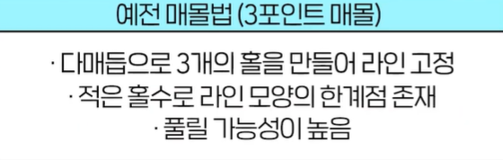 자연유착 vs 매몰 쌍꺼풀, 같은 비절개인데 왜 다를까요? 관련 이미지 3