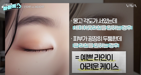 세미아웃라인 인아웃라인 쌍꺼풀 잘 받는 타입 (몽고주름) 관련 이미지 11