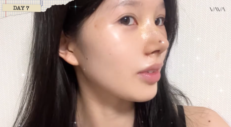 압구정 바바성형외과 자가늑 코성형 후기｜복코&middot;매부리코 교정 한달차 변화 관련 이미지 15