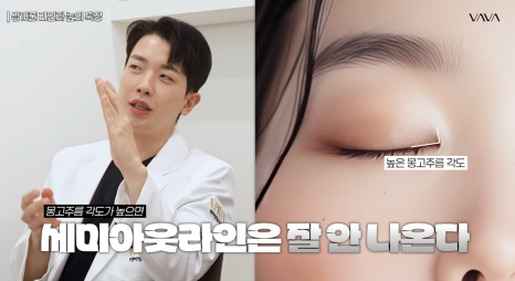 과하지 않게 또렷한 눈매, 세미아웃라인&middot;인아웃라인 쌍꺼풀 인기 이유 관련 이미지 10