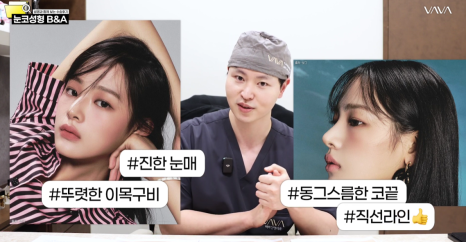 복코 매부리코 긴코 교정 ㅣ 코성형 전후 케이스 (NJZ민지 코) 관련 이미지 3