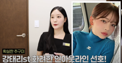 바바성형외과 절개 쌍수 절개 눈매교정 쌍꺼풀  재수술  사례 관련 이미지 8