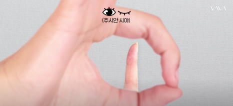 쌍수 후 생겨버린 짝눈 교정 눈의 균형을 맞추는 섬세한 방식 관련 이미지 23