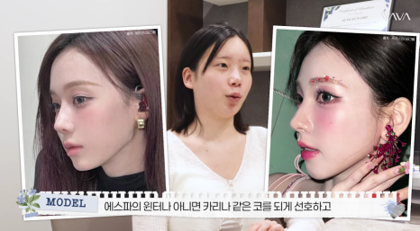 바바성형외과 눈&middot;코 성형 한 달 차 리얼 케이스 (윈터, 카리나 코) 관련 이미지 3