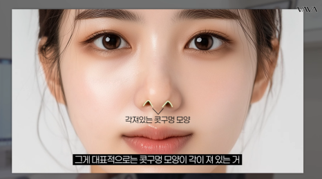 2026년 코성형 트렌드 예측콧대에서 코끝, 그리고 콧구멍까지 보는 시대 관련 이미지 9