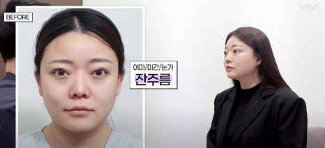 결혼식 전, 더 예쁜 나를 위한 작은 준비 (웨딩 시술 리얼 후기) 관련 이미지 11