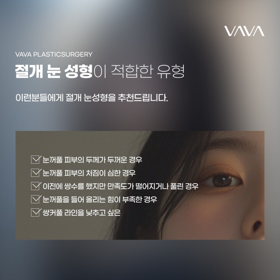 절개 눈성형 방법과 절개가 필요한 눈 유형 관련 이미지 4