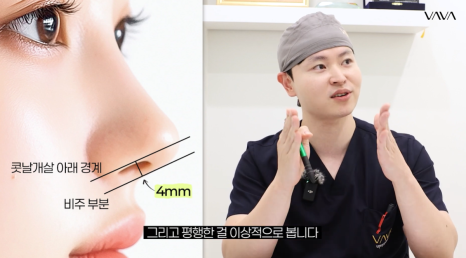 2026년 코성형 트렌드 예측콧대에서 코끝, 그리고 콧구멍까지 보는 시대 관련 이미지 6