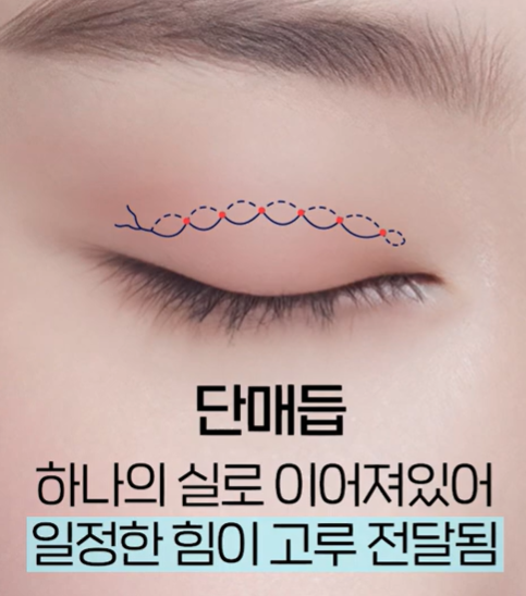 자연유착 vs 매몰 쌍꺼풀, 같은 비절개인데 왜 다를까요? 관련 이미지 7