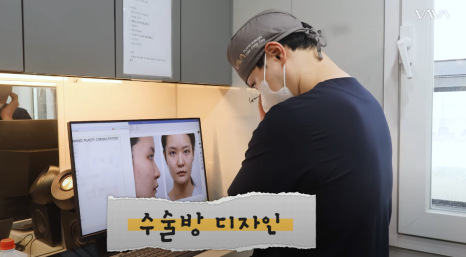 바바성형외과 복코&middot;매부리코&middot;휜코 동시 교정! 직반라인 코성형 리얼 후기 관련 이미지 7