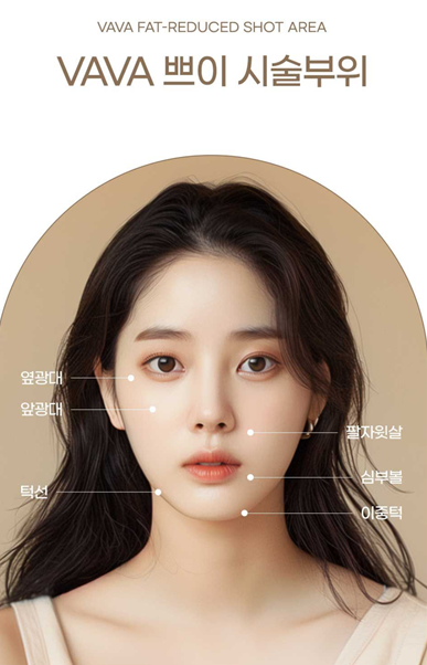 결혼식 전, 더 예쁜 나를 위한 작은 준비 (웨딩 시술 리얼 후기) 관련 이미지 7