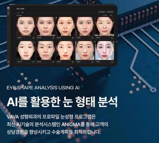 겨울방학 쌍꺼풀 수술, 이것만은 꼭 알아두세요｜쌍꺼풀 수술 가이드 관련 이미지 13