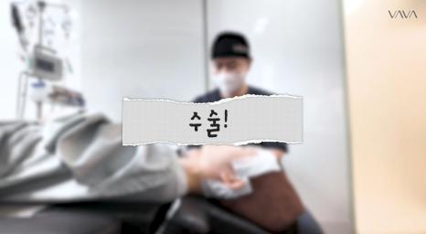 압구정 바바성형외과 자가늑 코성형 후기｜복코&middot;매부리코 교정 한달차 변화 관련 이미지 8