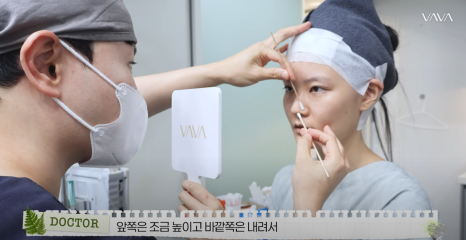 바바성형외과 복코&middot;매부리코&middot;휜코 동시 교정! 직반라인 코성형 리얼 후기 관련 이미지 4