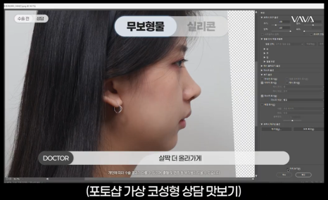 코수술 전 포토샵으로 결과를 확인하는 이유 ㅣ 바바성형외과 코수술 가상성형 상담 관련 이미지 3