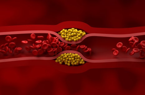 쌍수 후 주의사항과 부기, 멍 관리 방법 관련 이미지 3