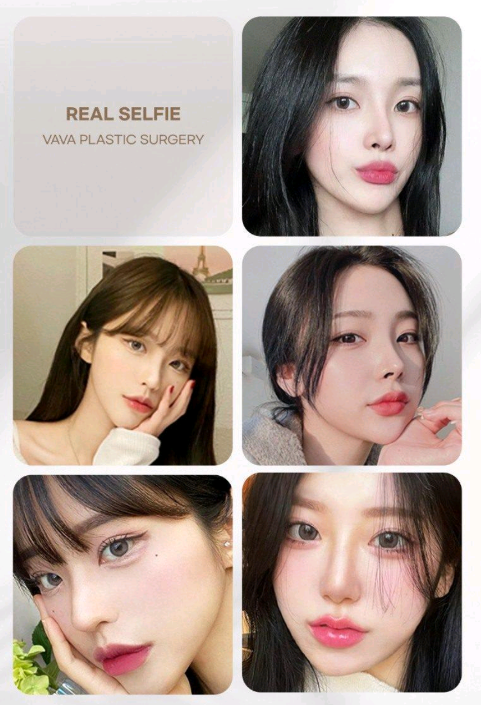 세련된 코끝 + 콧대라인, 바바성형외과의 트렌디 코성형 노하우 관련 이미지 13